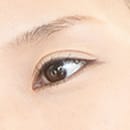 スーパーナチュラル目の上のたるみ取り【画像】