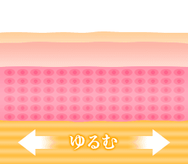 注入後