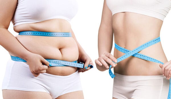 医療ダイエットのメリット【画像】