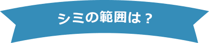 シミの範囲は？【画像】