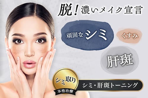 脱！濃いメイク宣言 頑固なシミ・肝斑・くすみ シミ取り本格治療 シミ・肝斑トーニング【画像】
