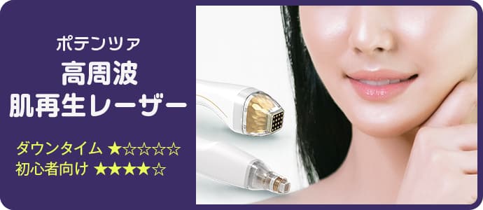 ポテンツァ 高周波肌再生レーザー ダウンタイム★☆☆☆☆ 初心者向け★★★★☆