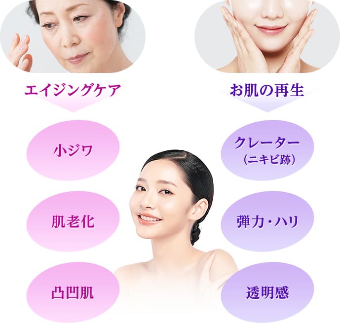エイジングケア→小ジワ 肌老化 凸凹肌 お肌の再生→クレーター（ニキビ跡） 弾力・ハリ 透明感