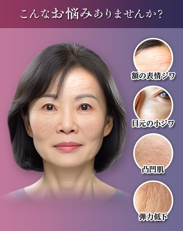 こんなお悩みありませんか？ 額の表情ジワ・目元の小ジワ・凸凹肌・弾力低下