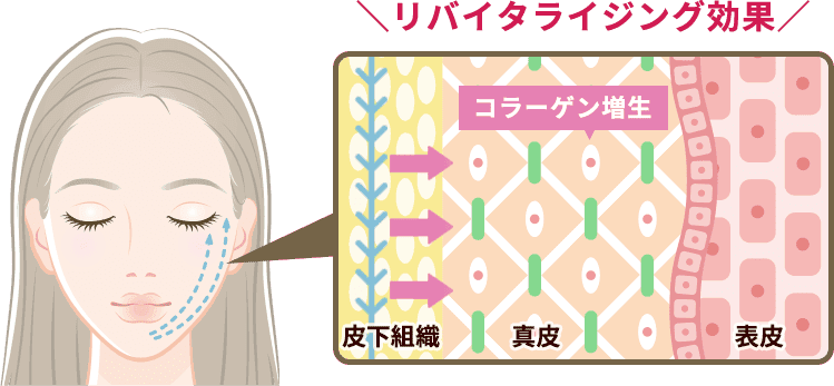 リバイタライジング効果【画像】
