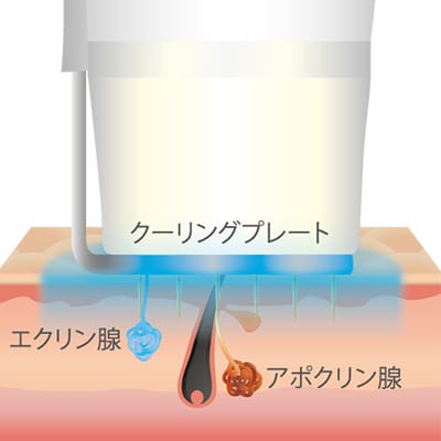 特許技術のクーリングプレート【画像】