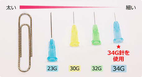 麻酔針は極細34G！痛みや腫れを極力少なく【画像】
