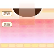 炭酸ガスレーザーのメカニズム1【画像】