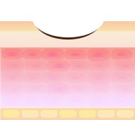 炭酸ガスレーザーのメカニズム2【画像】