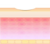 炭酸ガスレーザーのメカニズム3【画像】