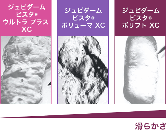 ジュビダームビスタ®ウルトラプラスXC ジュビダームビスタ®ボリューマXC ジュビダームビスタ®ボリフトXC 滑らかさ