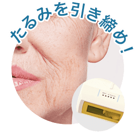 たるみを引き締め!【画像】