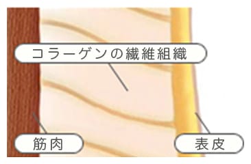 ゆるくなったコラーゲン繊維【画像】
