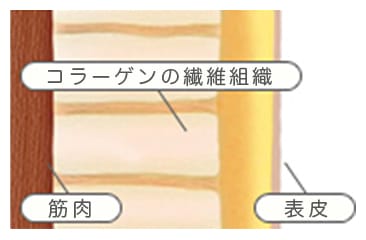 コラーゲン繊維を5～15%収縮させ、さらに新しいコラーゲン繊維を再構築【画像】