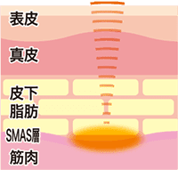 蓄熱方式