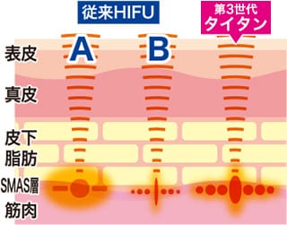 痛みを大幅に軽減