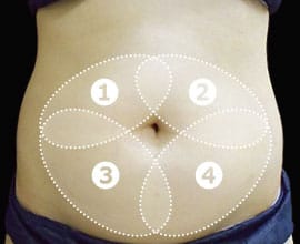 クールスカルプティング®：脂肪を冷却して破壊する痩身術。治療部位2【画像】