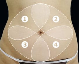 クールスカルプティング®：脂肪を冷却して破壊する痩身術。治療部位5【画像】