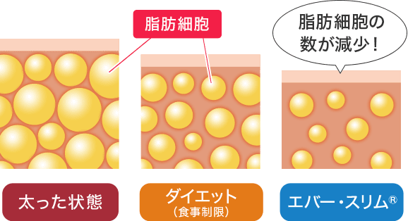 脂肪細胞は太った状態よりもダイエット(食事制限)時のほうが少なく、それよりもエバー・スリム®のほうが少ないです