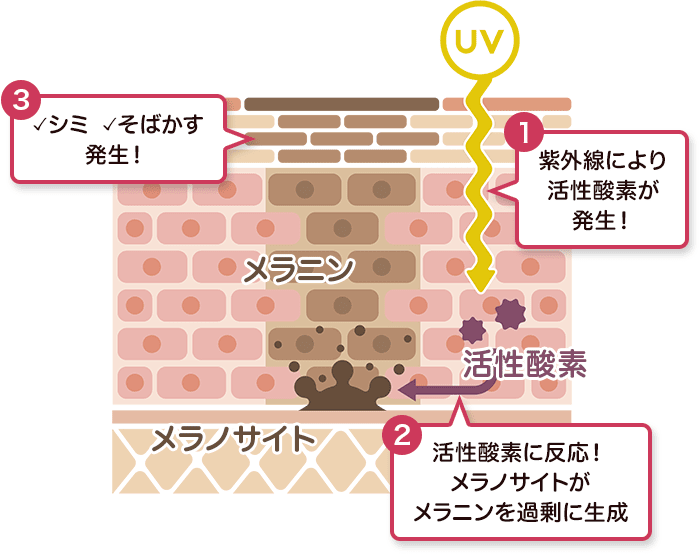 シミができる原因は?【画像】