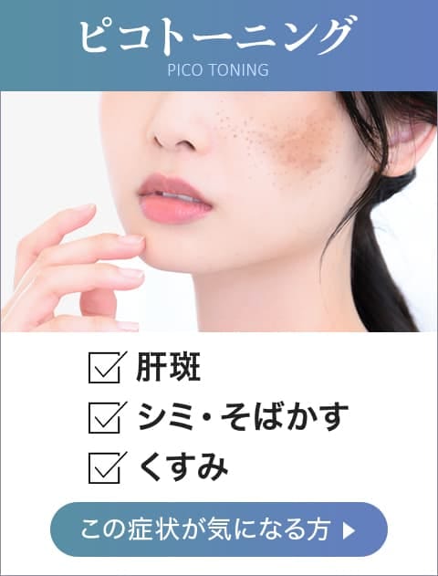 ピコトーニング 肝斑、シミ・そばかす、くすみ この症状が気になる方【画像】