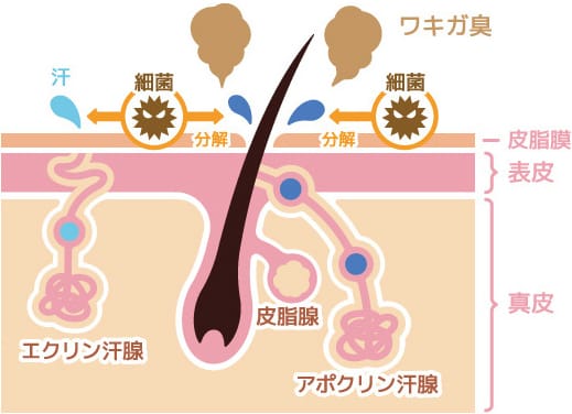 ワキガ【画像】