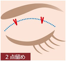 二点留めの説明画像1【画像】