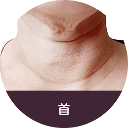 首