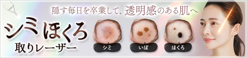 隠す毎日を卒業して、透明感のある肌へ シミほくろ取りレーザー シミ/いぼ/ほくろ
