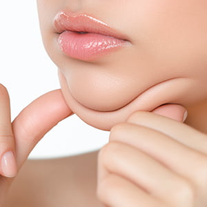 表参道院の小顔治療