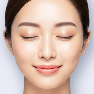 ジュビダームビスタ&reg;ウルトラXC【画像】