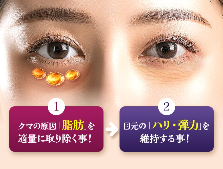 ①クマの元となる脂肪をバランスよく除去すること！②目元のハリや弾力をキープして窪まないようにする！