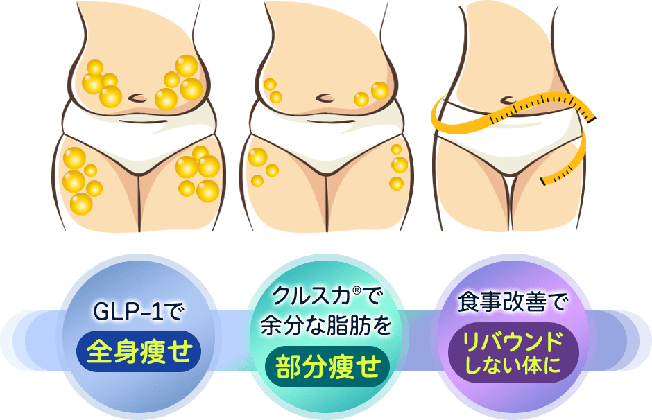 全身痩せたいならGLP-1 部分的に痩せたいならクールスカルプティング® 管理栄養士のアドバイスでリバウンドを阻止