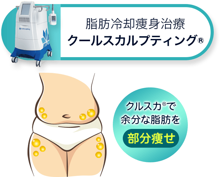 脂肪冷却痩身治療 クールスカルプティング® 部分的に痩せたいならクールスカルプティング®
