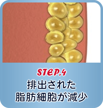 STEP.4 排出分、脂肪細胞数が減る