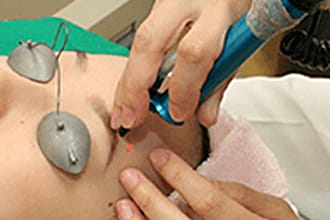 Step.4 治療【画像】