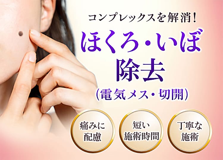 コンプレックスを解消！ほくろ・いぼ除去（電気メス・切開） 痛みに配慮・短い施術時間・丁寧な施術