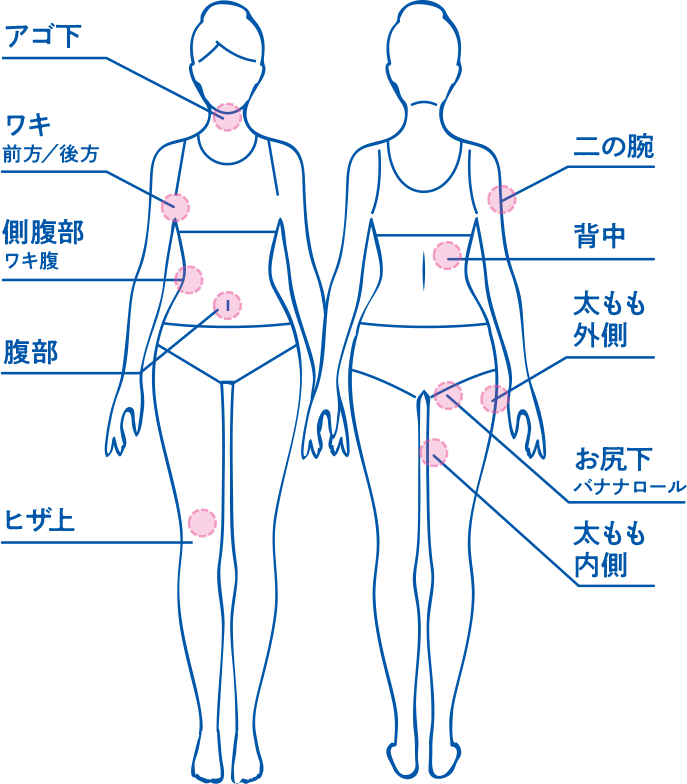 クールスカルプティングの適応部位一覧